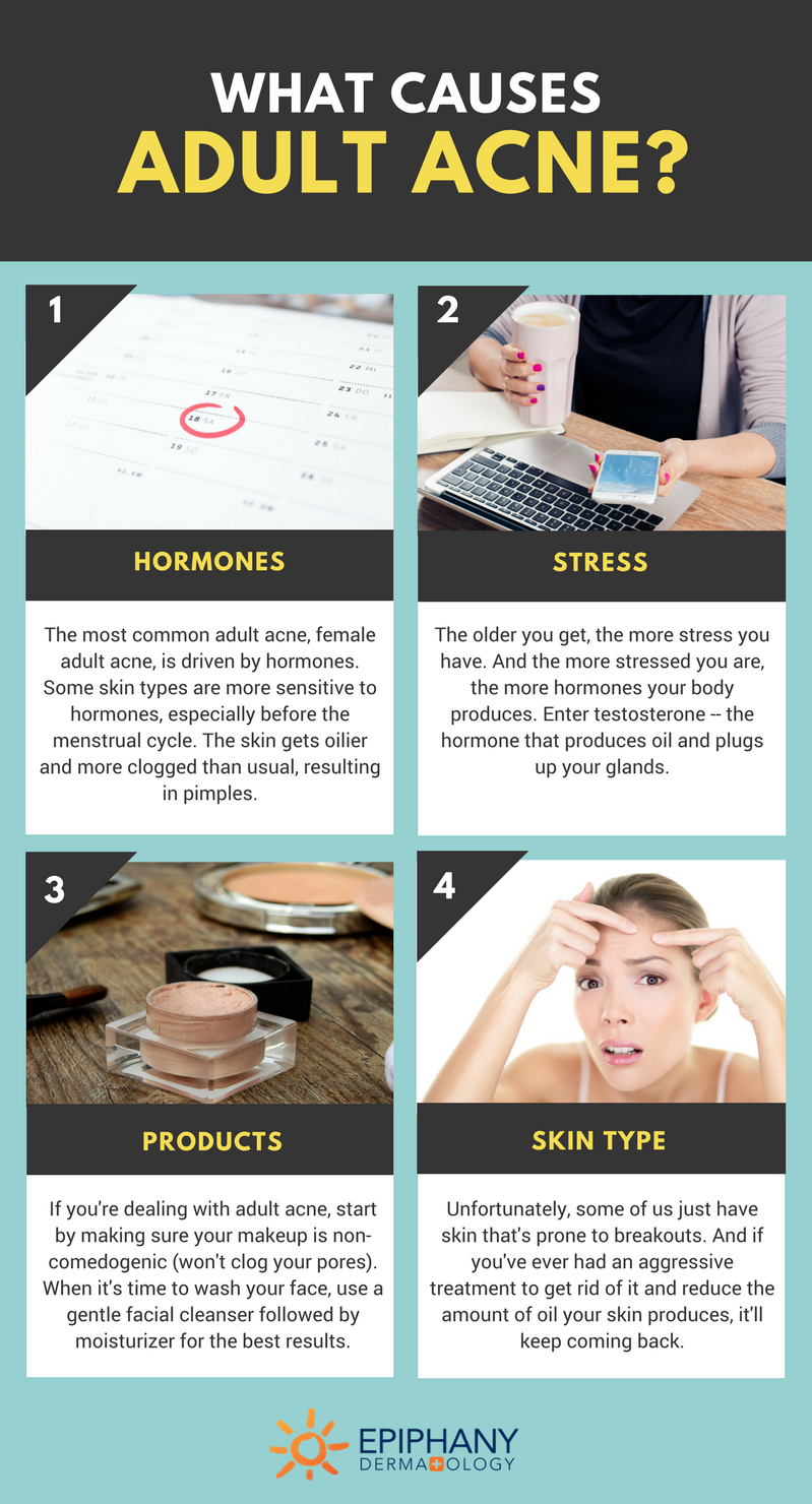 Causes of Adult Acne Causes of Adult Acne