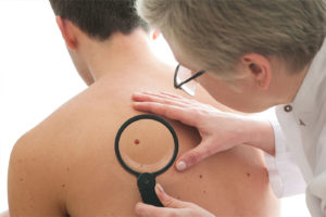 biopsies male