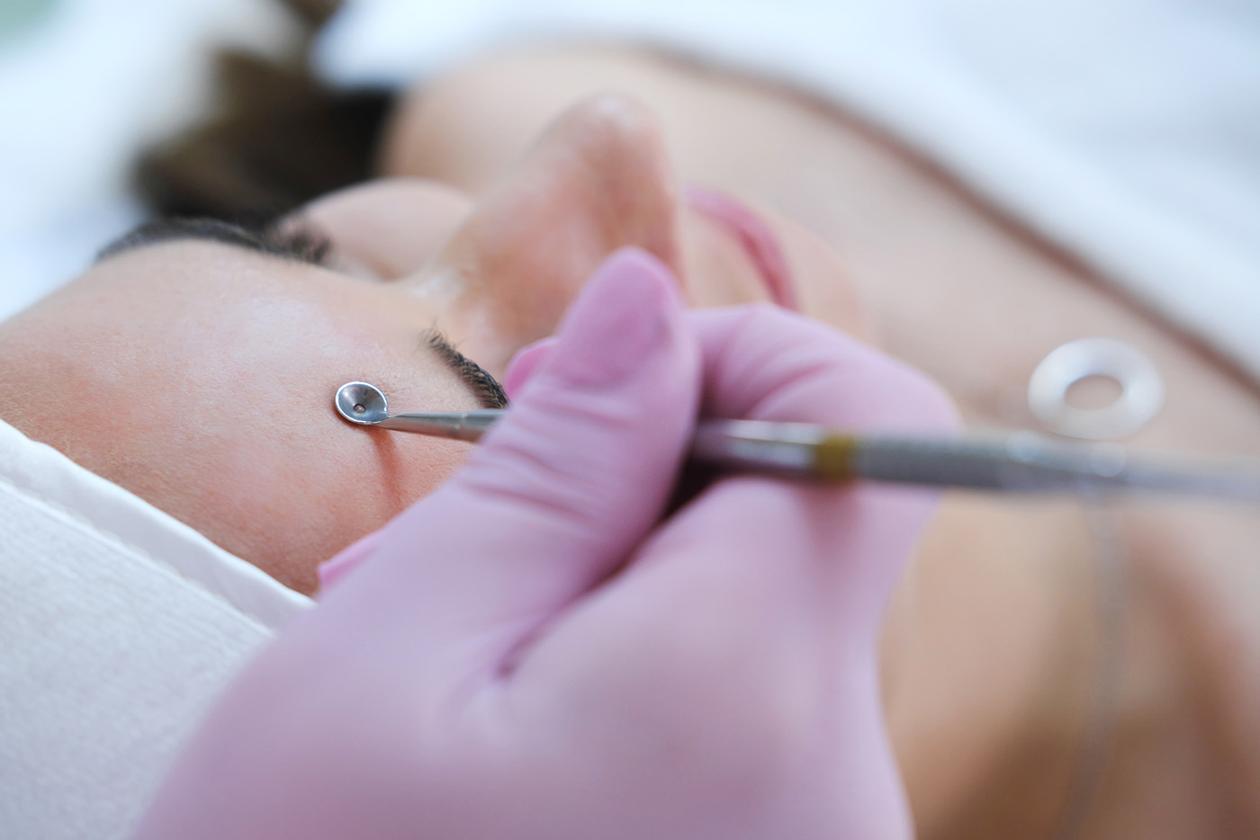 extractions